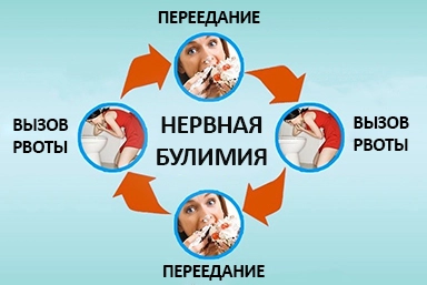 Лечение булимии в Зеленокумске